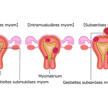 bh-800x450-Myome-01 Myome