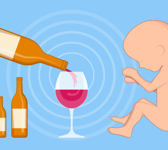 FASD