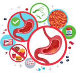 Gastritis
