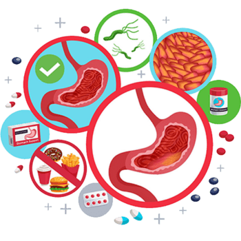 Gastritis