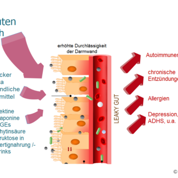 Leaky-Gut-Syndrom (LGS)