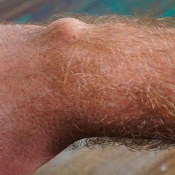 wp-header-1300x500-Ganglion Ganglion