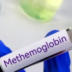 Methaemoglobinaemie