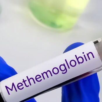wp-header-1300x500-Methaemoglobinaemie Methaemoglobinaemie