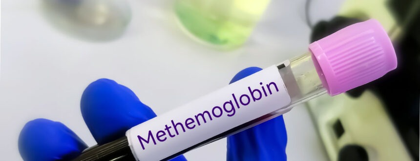 Methaemoglobinaemie