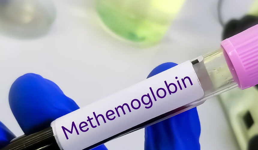 Methaemoglobinaemie